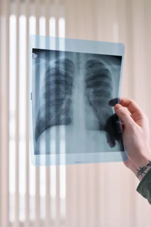 Hand Holding X-Ray Image