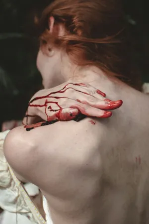 Injured Woman