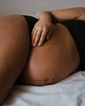 Maternity Scar