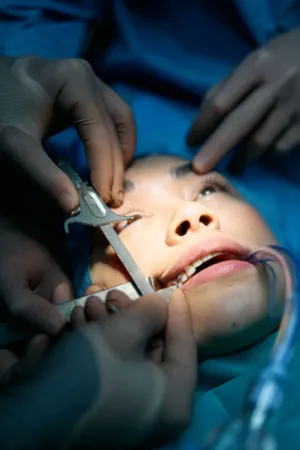Eye Surgery