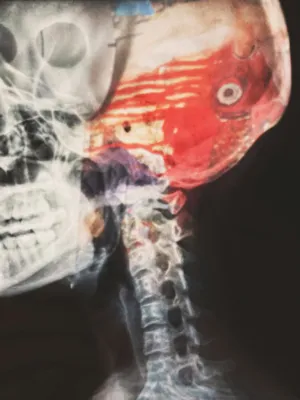 Abstract X-Ray Art