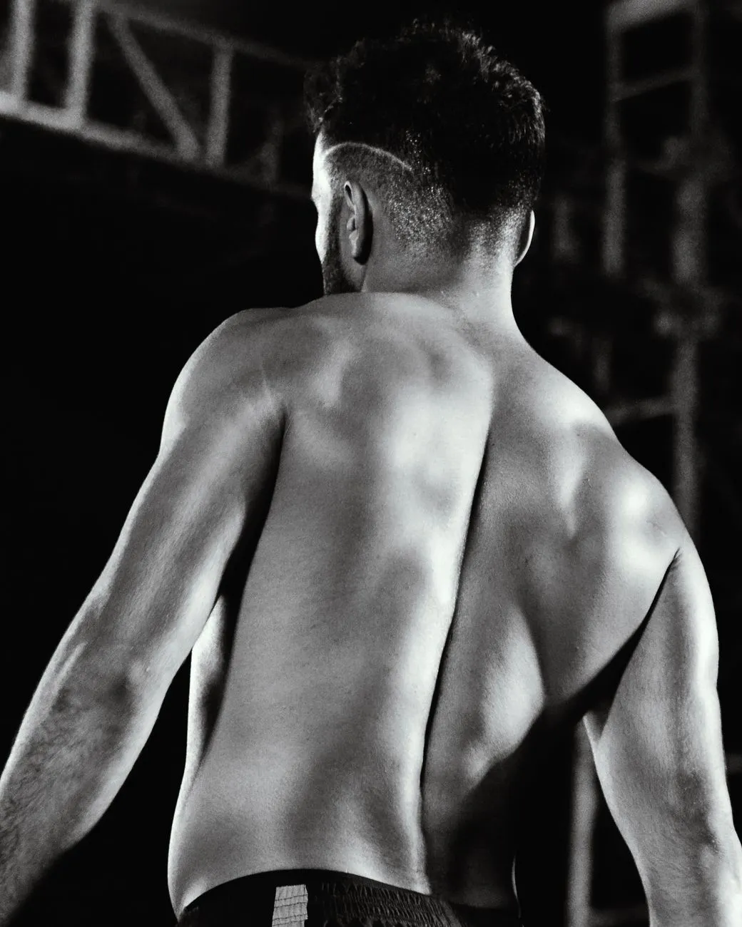 Athlete'S Back