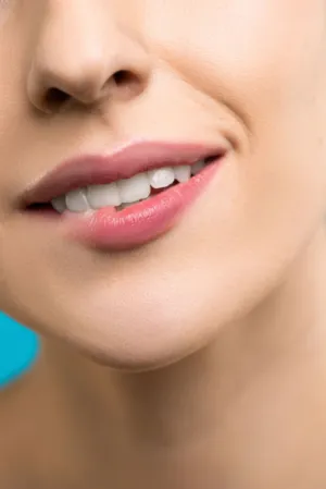 Perfect Smile