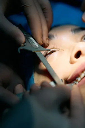 Surgical Procedure