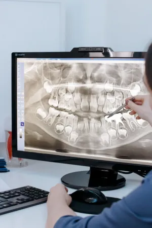 Dental X-Ray Analysis