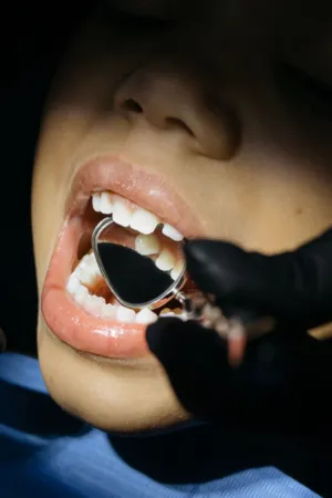 Dental Check-Up