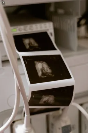 Ultrasound Printout
