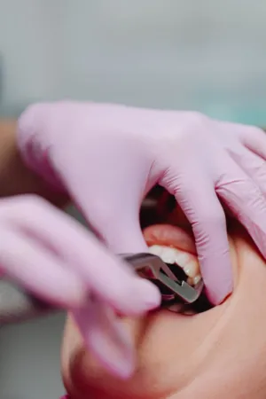 Dental Check-Up
