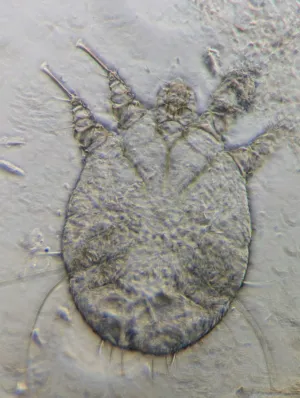 Microscopic Mite
