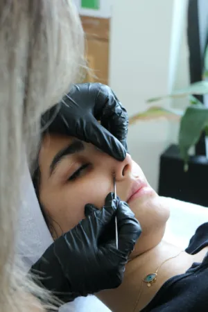 Skin Care Treatment